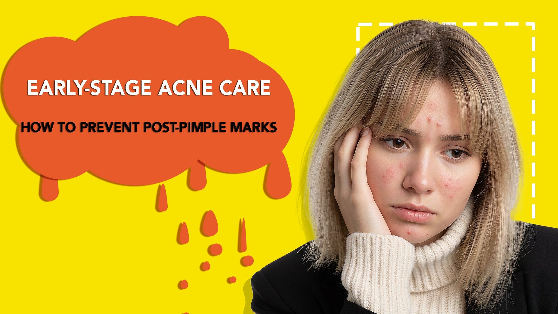 Early-Stage Acne Care: How to Prevent Post-Pimple Marks | Tarel Laboratory